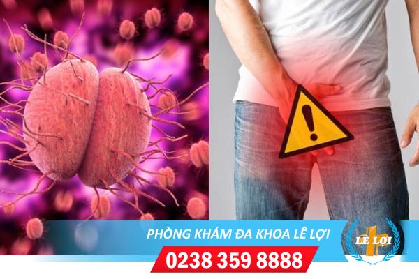 Bệnh lậu bị tái phát phải làm sao?