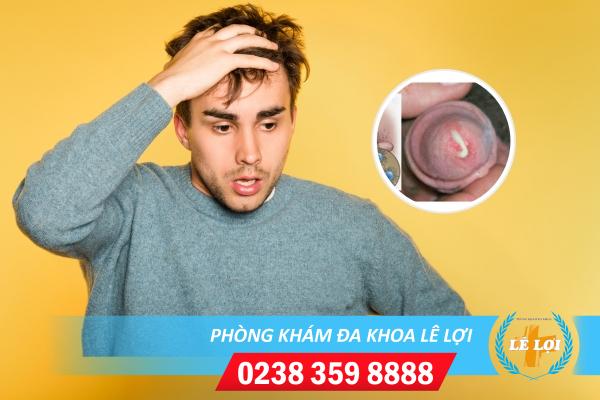 Bệnh lậu tự khỏi không?