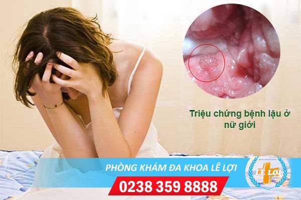 Phòng khám chữa bệnh lậu hiệu quả nhanh, chi phí hợp lý