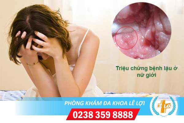 Bệnh lậu chữa bao lâu khỏi?