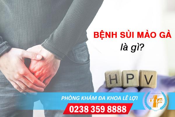 Cách chữa sùi mào gà ở nam hiệu quả, không đau, phí thấp
