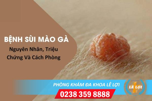 Thông tin về bệnh sùi mào gà bạn cần biết