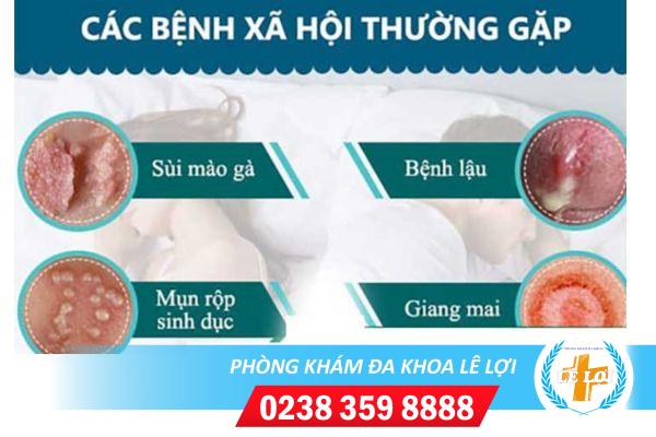 Phòng khám chữa bệnh xã hội nhanh hết, ngăn tái phát