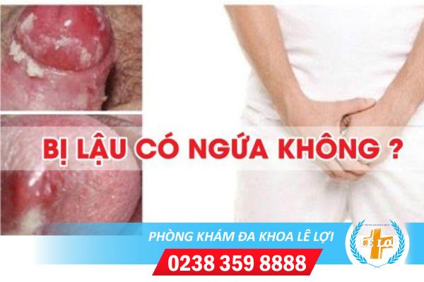 Bệnh lậu có ngứa không?