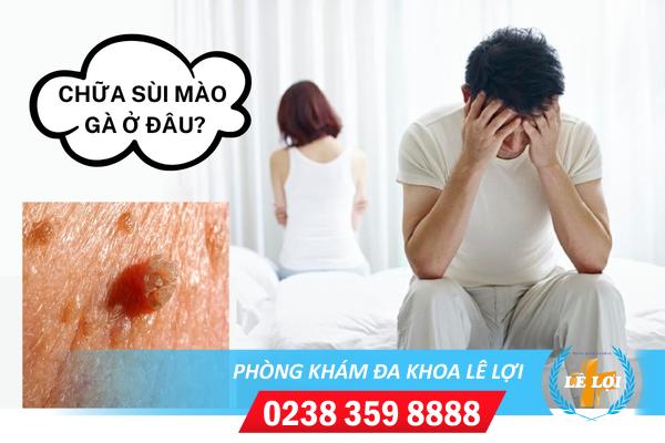 Chữa sùi mào gà ở đâu nghệ an?