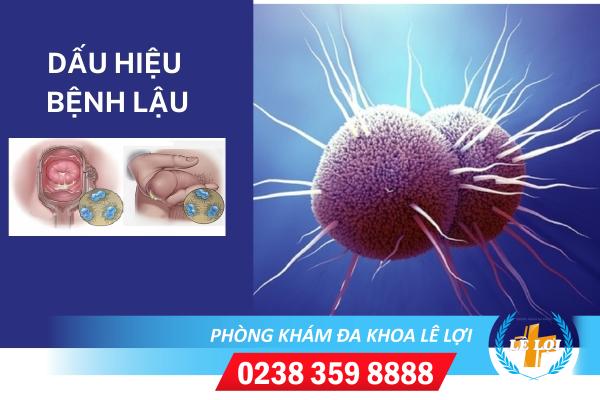 Dấu hiệu bệnh lậu và cách khắc phục