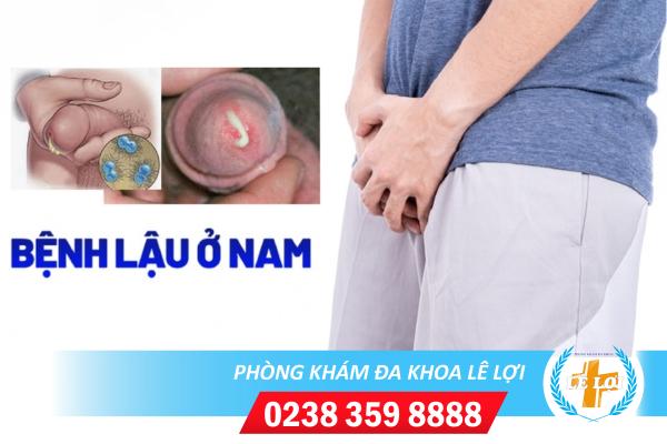 dau-hieu-benh-lau-o-nam-gioi