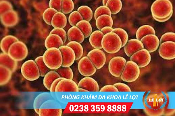 Bệnh lậu giai đoạn 2 và những biến chứng nguy hiểm