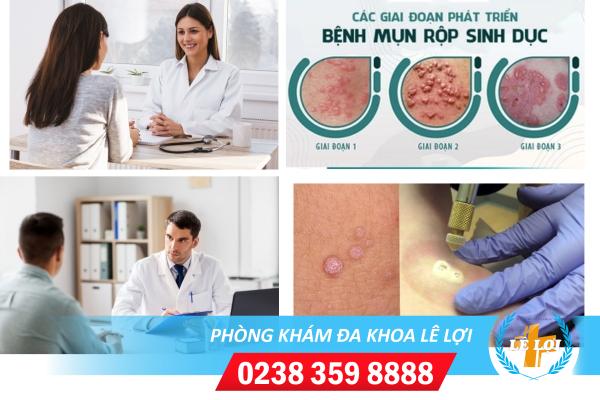 Phòng khám chữa mụn rộp sinh dục tốt uy tín