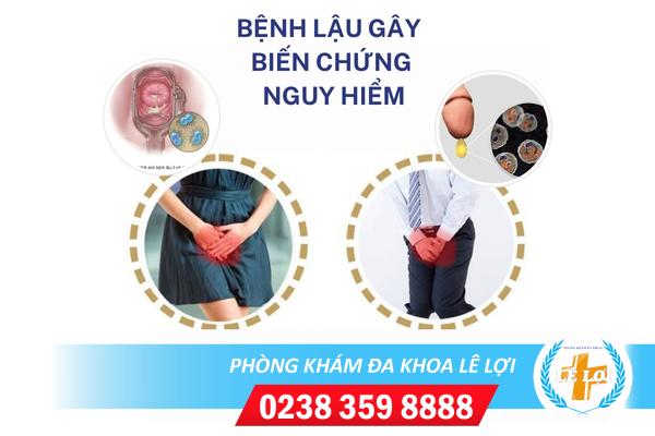 xet-nghiem-benh-lau-o-dau
