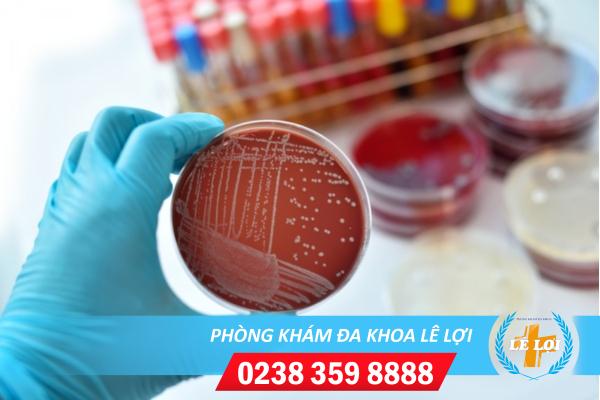 Địa chỉ xét nghiệm bệnh lậu uy tín ở Vinh