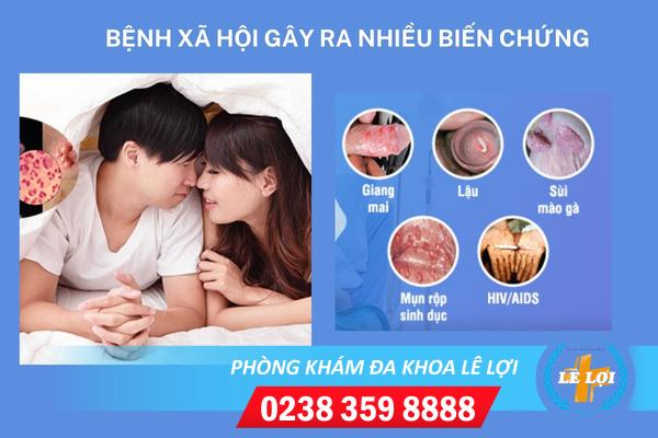 chua-benh-xa-hoi-o-dau-hieu-qua